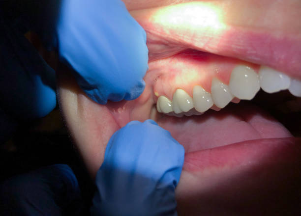Best After-Hours Emergency Dentist in Brodhead, KY