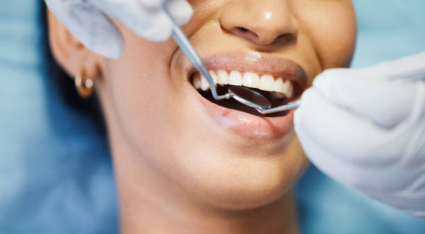 Best Emergency Root Canal Treatment in Brodhead, KY