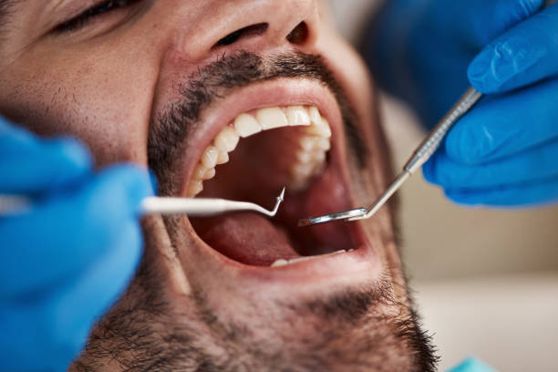 Best Walk-In Emergency Dentist in Brodhead, KY