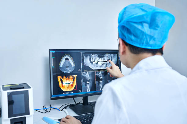 Best Emergency Wisdom Teeth Removal in Brodhead, KY