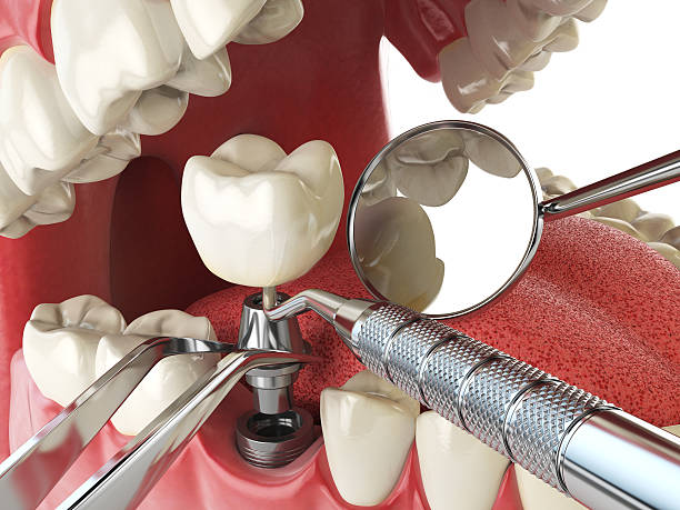 Best Walk-In Emergency Dentist in Brodhead, KY