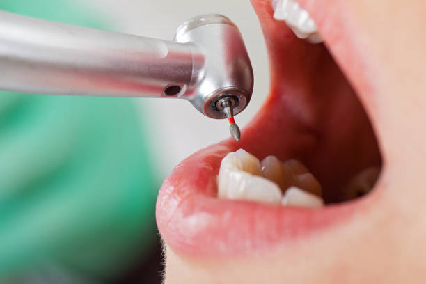 Best Emergency Treatment for Toothache in Brodhead, KY